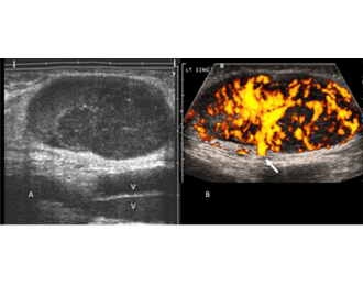 /Content/ServiceImages/Doppler – S Joints.png